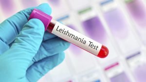 test leishmania